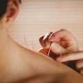 Conditions Treated by Acupuncture: A Holistic Approach to Health and Wellness