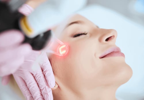 The Power of Laser Skin Rejuvenation