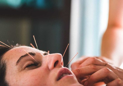 Finding a Qualified Acupuncturist for Holistic Health and Anti-Aging