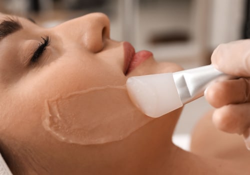 The Surprising Benefits of Chemical Peels for Skin and Overall Well-Being