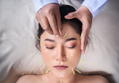 Understanding How Acupuncture Works for Holistic Health and Anti-Aging