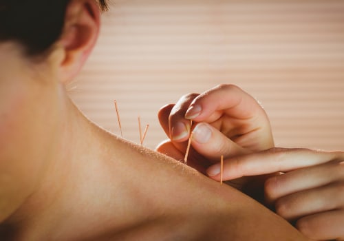 Conditions Treated by Acupuncture: A Holistic Approach to Health and Wellness